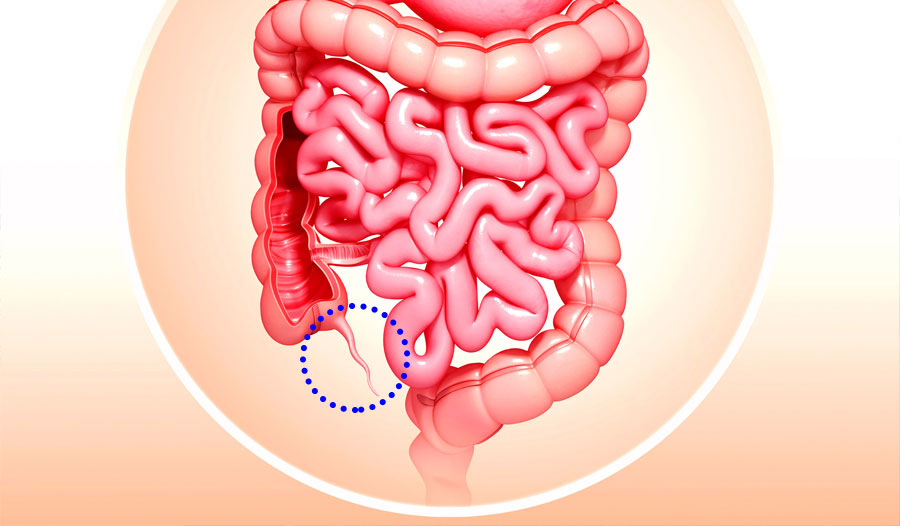 阑尾——有多种功能，但仍然是进化论的证据？
